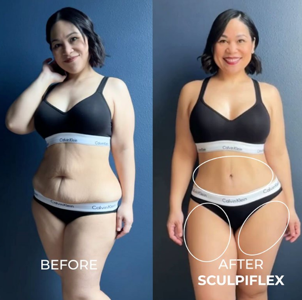 Sculpiflex Full Kit